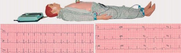 “多种心电图电脑模拟人