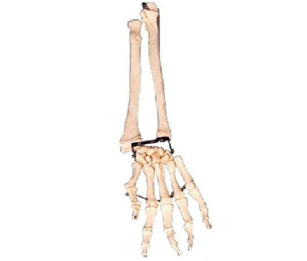 “手臂骨带尺骨与挠骨模型