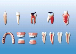 “牙齿病变系列模型
