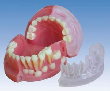 “三岁乳恒牙交替解剖模型