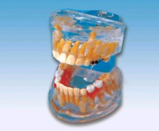 “透明乳牙发育模型