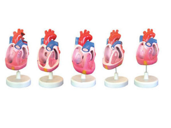 “先天性心脏畸形模型（5部件）